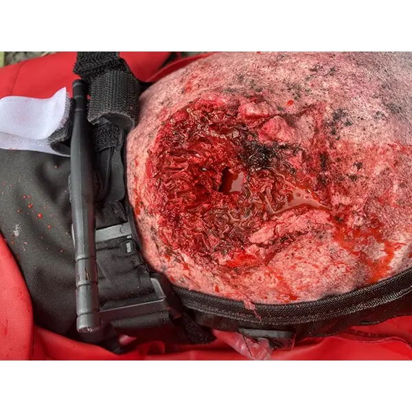 Ruth Lee™ Trauma Rescue Manikin - Image 10